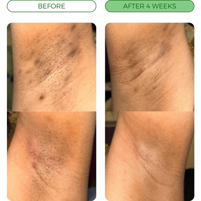 Brightening bar - against dark spots & uneven skin tone