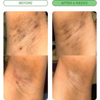 Brightening bar - against dark spots & uneven skin tone