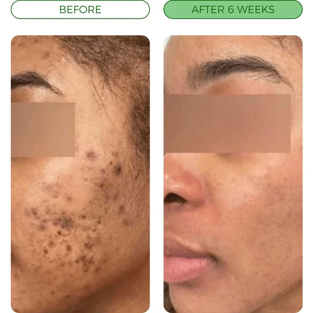 Brightening bar - against dark spots & uneven skin tone